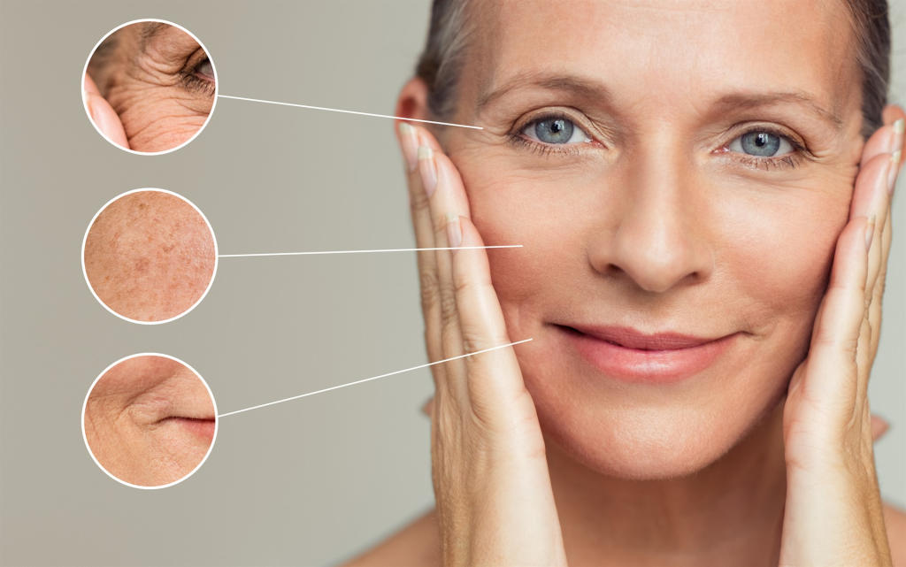 aging and skin