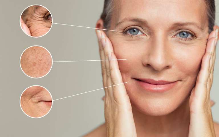 aging and skin